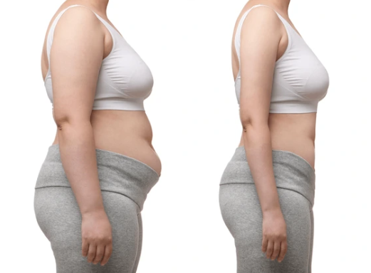 Weight Loss Solution By Dr. Rubina